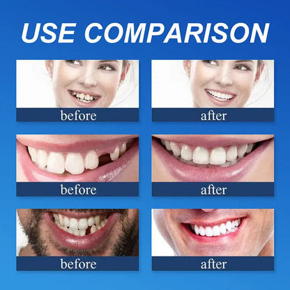 👑2026 Eaily Hot Sale Ends Today: 70% OFF! Luna Cipher Custom Custom-Fit Full Functional DenturesMake you more confident – Made in the USA