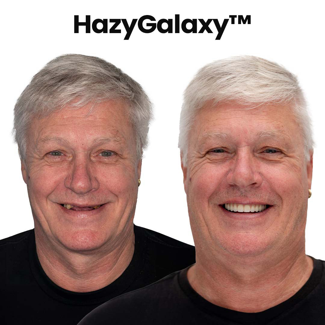 -🦷HazyGalaxy™ Custom-Fit Functional Dentures — Made in the USA, Up to 70% OFF for a More Confident Smile!