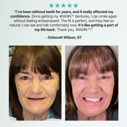 -🦷HazyGalaxy™ Custom-Fit Functional Dentures — Made in the USA, Up to 70% OFF for a More Confident Smile!