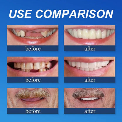 🔥Ends Today: 75% OFF! ⏰DarkFairy™ Medical Full Denture with Strong Suctiond Custom-Fit Full Functional Dentures🦷